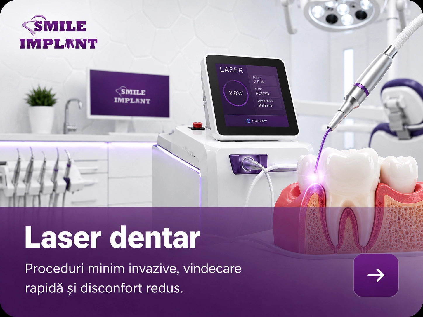 laser dentar - ok