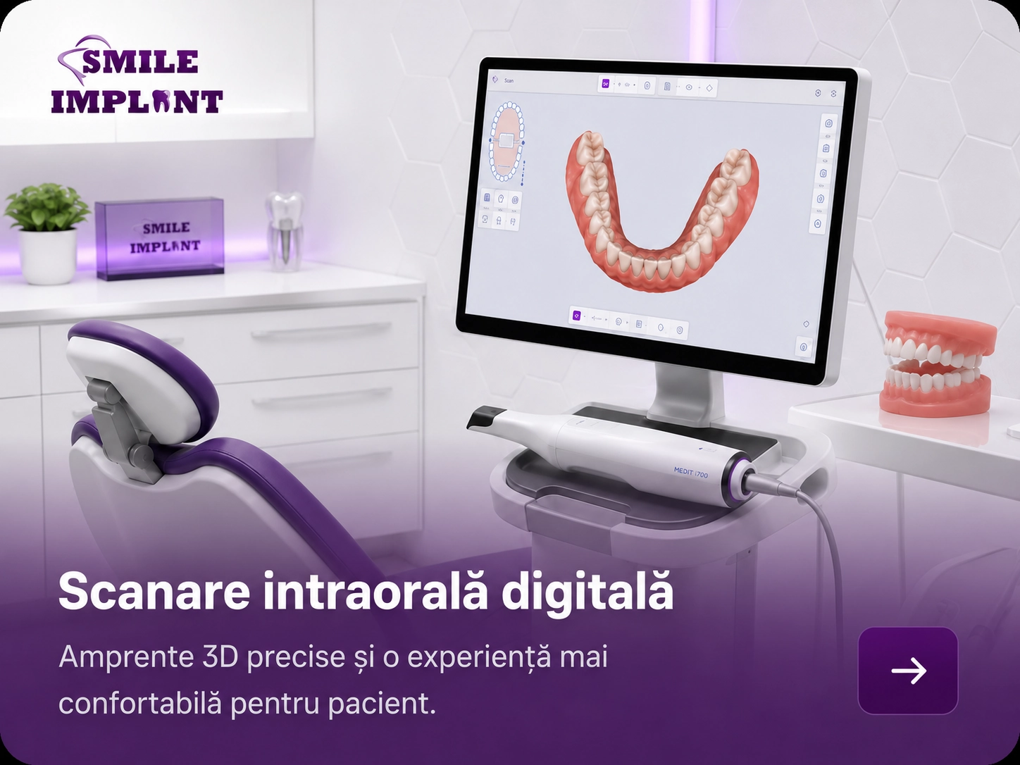 scanare intraorala digitala - ok